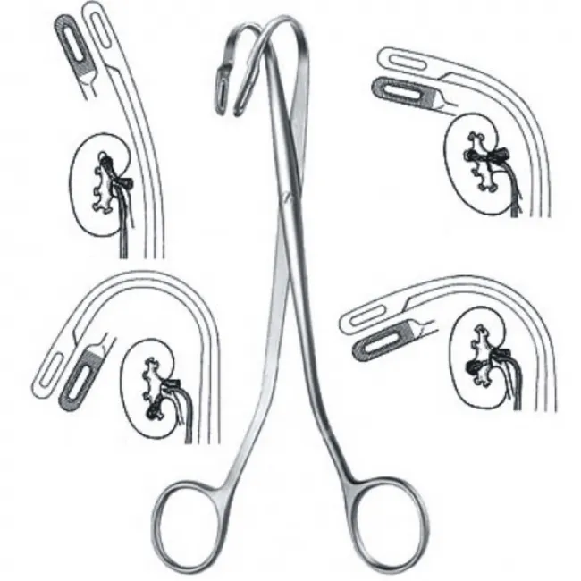 kidney stone forceps kidney stone forceps